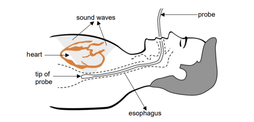 tee shirt enfant pas cher